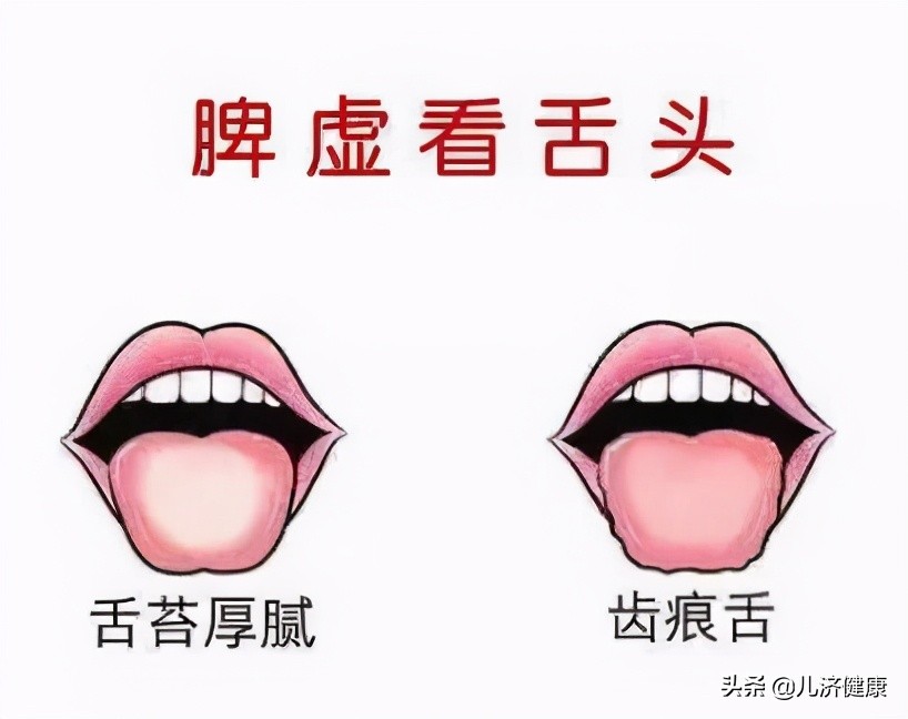 脾虚百病生教你一招益气健脾,脾虚湿盛健脾益气祛湿中成药