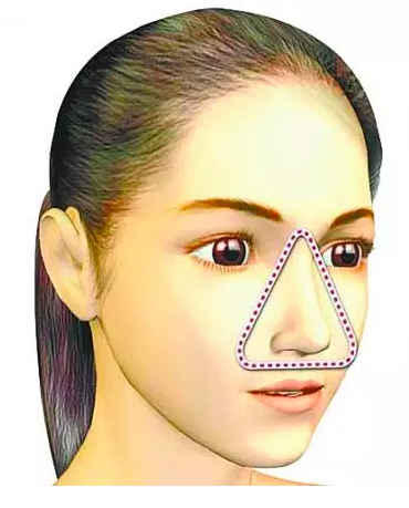 人体危险的三角区在哪里,人面部危险三角区