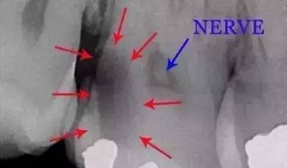 看牙不拍片直接说费用,医院看牙拍片贵吗