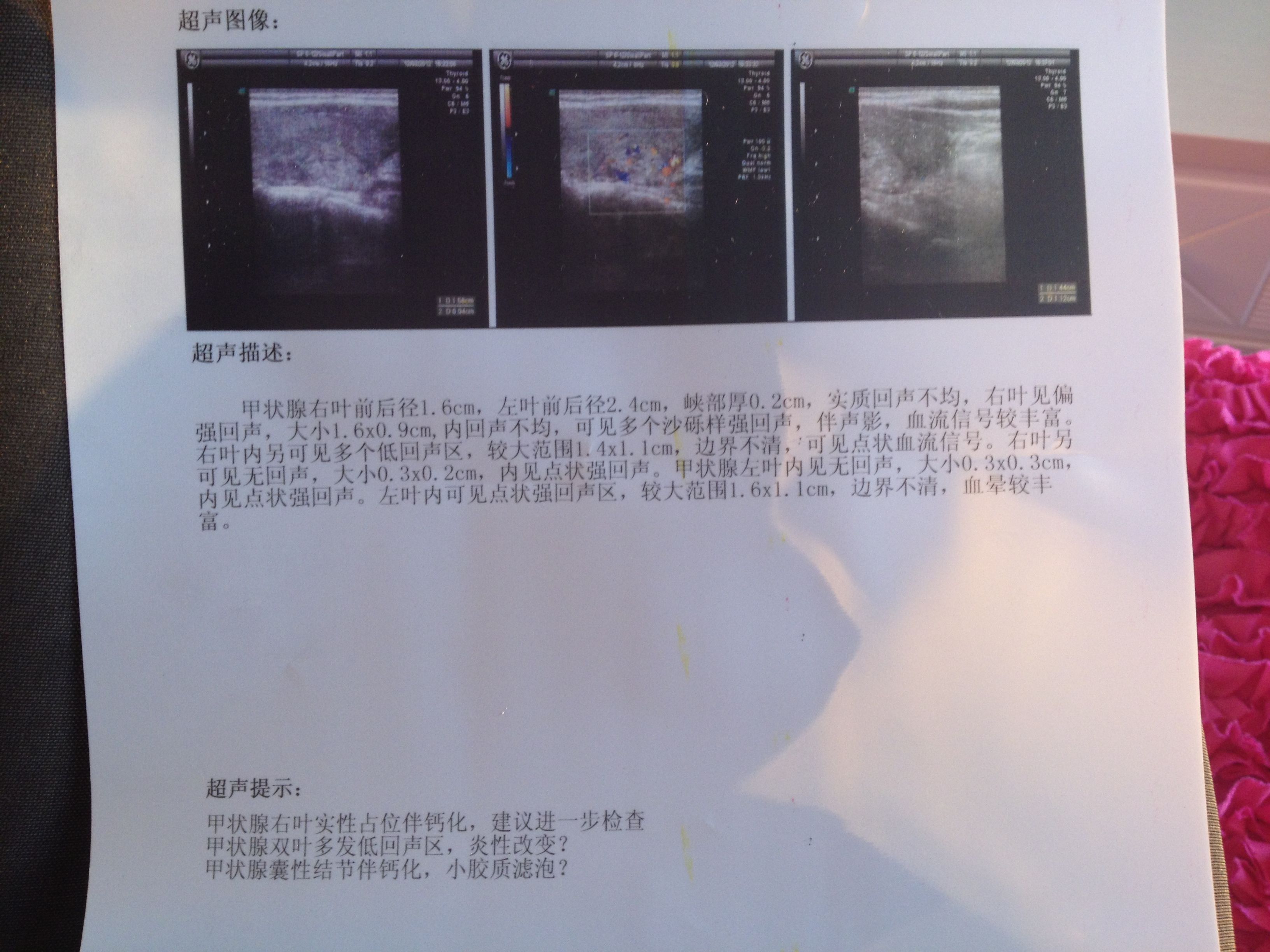 王玉芬教授：彩超报告，无回声、低回声、强回声是什么意思？