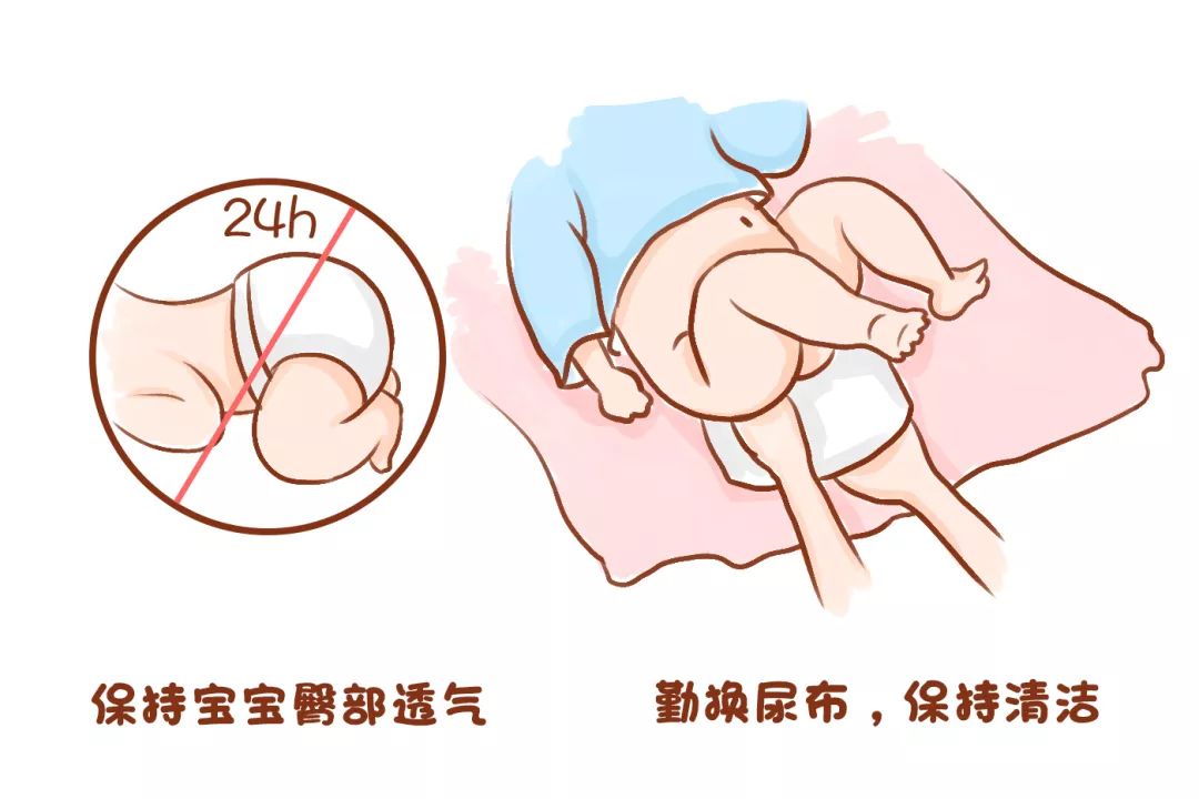 宝宝“红屁股”反反复复？别总让纸尿裤背锅，孕妈护理也有错