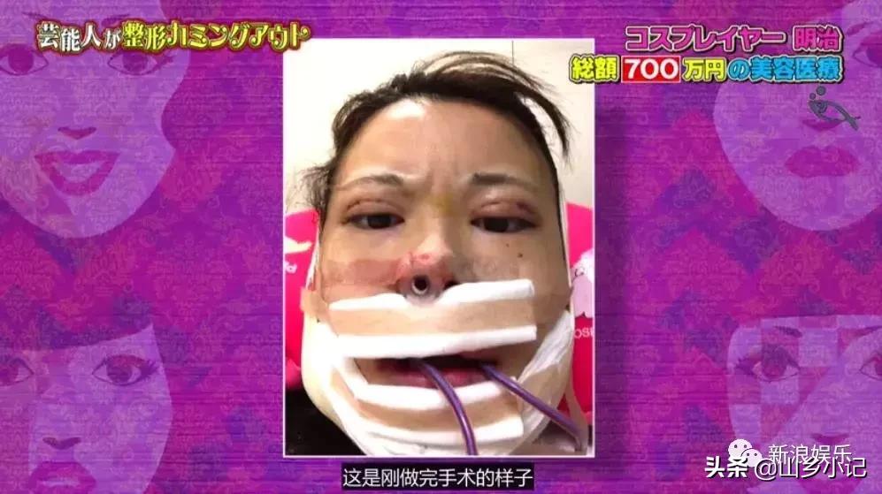 明明是整容脸现在却成了颜值巅峰,明明是整容脸却没被吐槽过