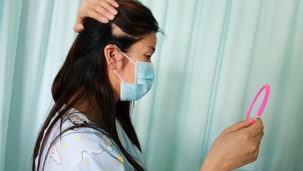 脱发的正确治疗方法和注意事项,脱发的常见类型与防治