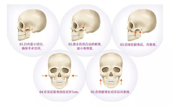 整容也就图一乐，真投胎还得买神水