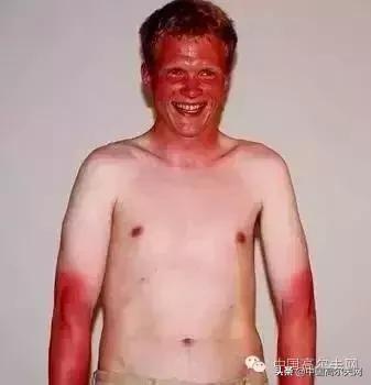 高尔夫重度中毒患者,高尔夫夹层中毒