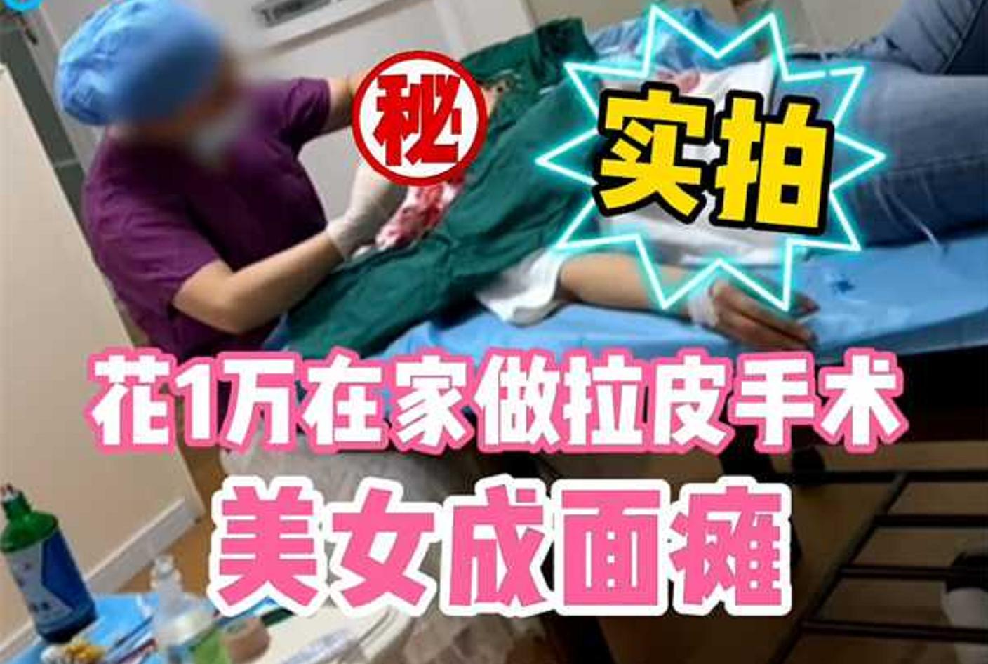 女子花1万块让朋友在家做拉皮手术，被医生诊断为面瘫，朋友曾非法行医被逮捕