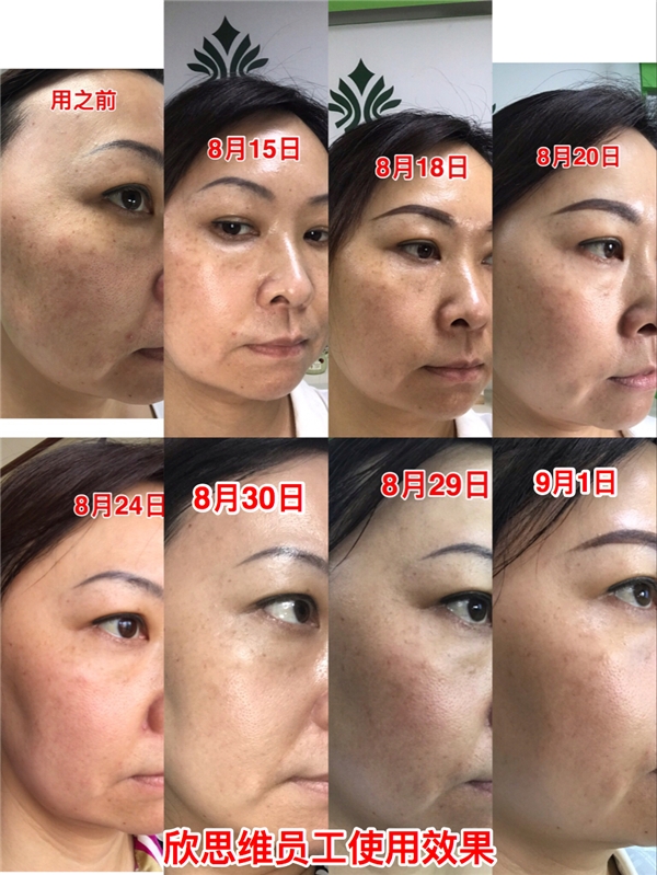 中国中医药非物质文化遗产保护——欣思维·彤颜绝斑原液组合