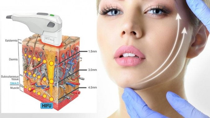 亳州利辛县热玛吉除皱术,亳州热玛吉除皱术