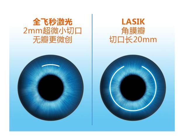 激光治疗近视眼手术十大危害,近视眼激光手术有什么风险和危害
