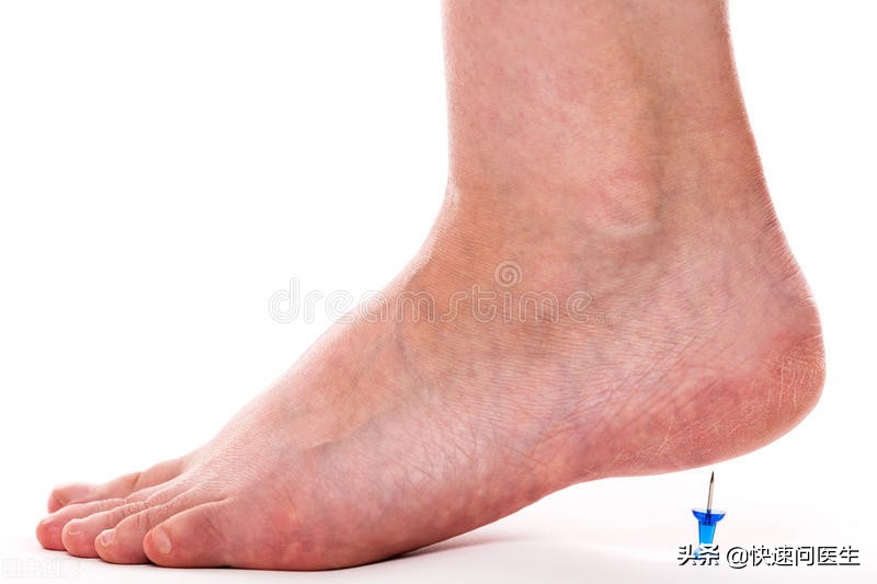 关节长了骨刺有偏方土方法治疗,关节炎和骨刺发生的原因是什么