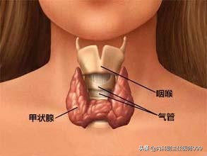 甲亢——轻松就能治好的慢病，李连杰等人却深受其害！