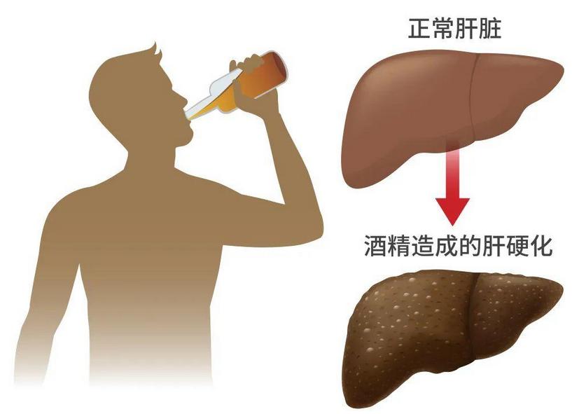 白酒最怕的解药不是浓茶,白酒最怕的解毒方法