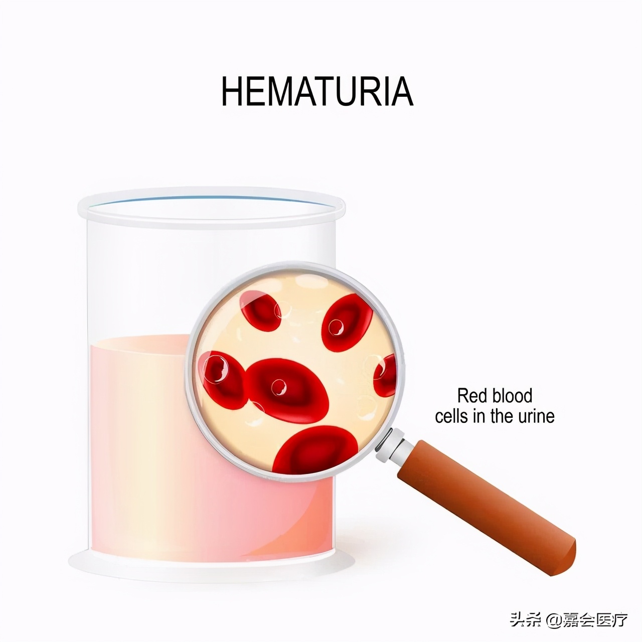 尿出橙色的尿是什么病,尿出的尿是荧光绿色是怎么回事