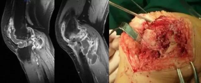 mri临床医师必读电子书,临床医生如何读mri