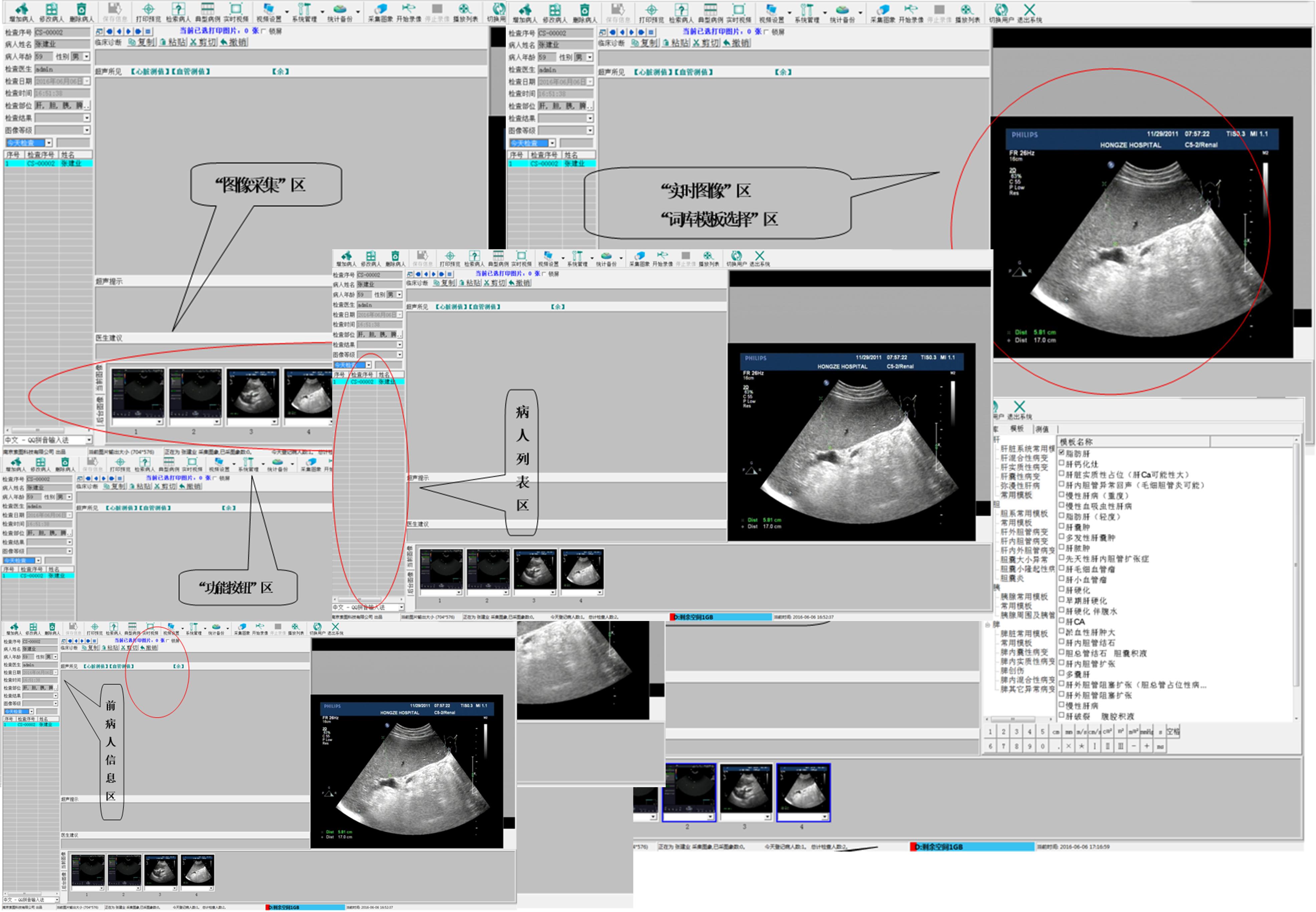 超声的未来,超声设备的发展趋势