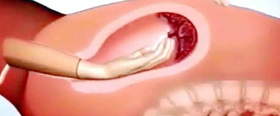 顺产究竟有多痛宝妈们,顺产多么疼