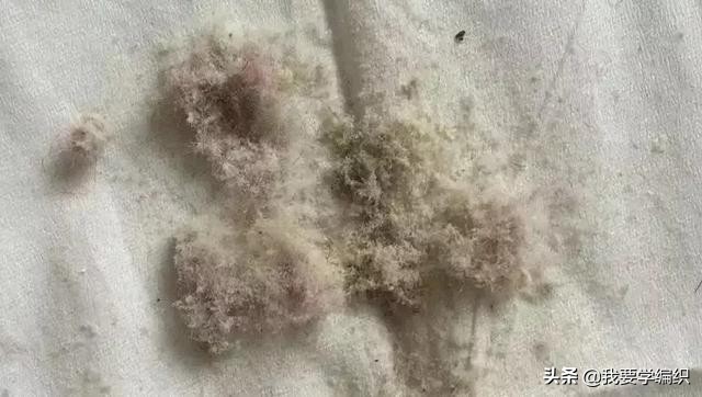 后背长痘的原因和改善方法,后背长痘太可怕了该怎样调理