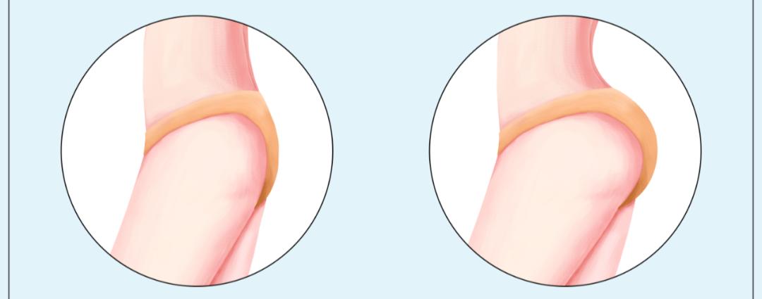 潜藏在医学美容背后的感染陷阱