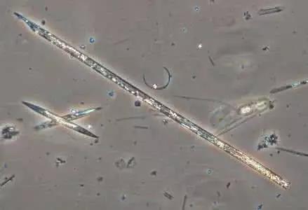 水产养殖藻类老化是怎样的,水产养殖显微镜下各种藻类