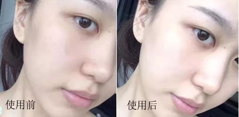 2块钱的它、竟然能亮白、祛痘印、淡斑！？太神奇了！