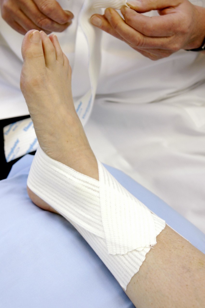 脚崴了可以用白酒擦拭吗,崴脚用白酒擦了还能冷敷吗