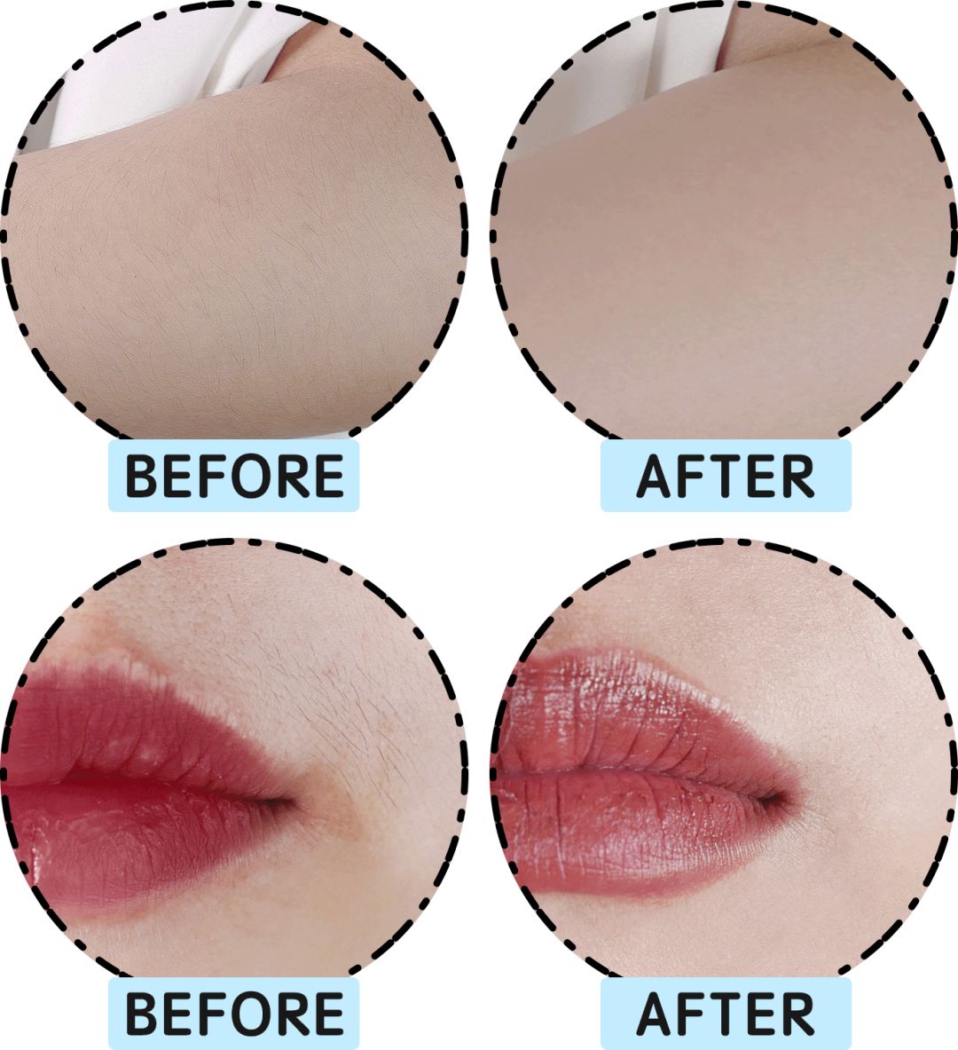 网红脱毛仪到底怎么样,脱毛仪网红都推荐什么牌子