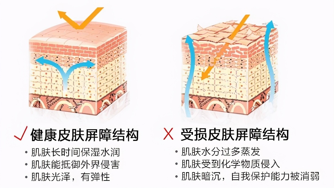 美容护肤冬季肌肤外油内干怎么办,肌肤屏障受损外油内干怎样修复