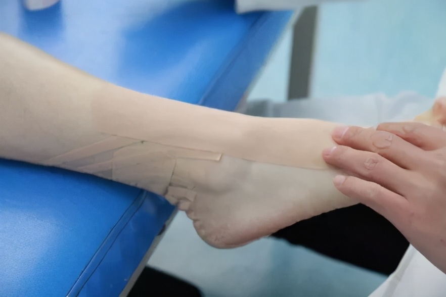 弹性贴布的原理,弹性贴布的作用