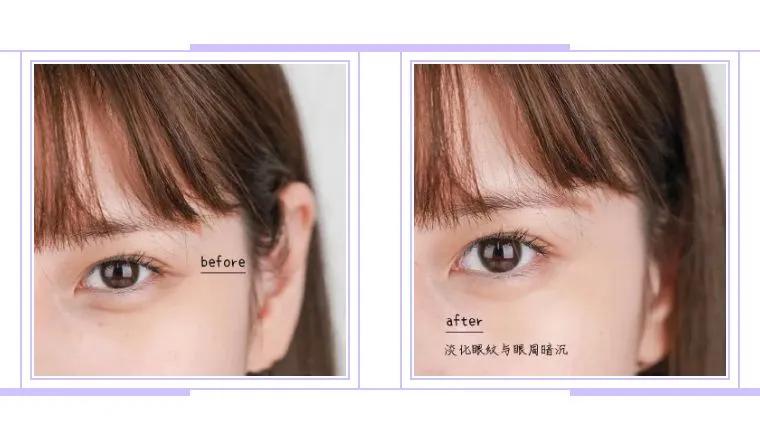 维a精研抗皱眼霜,维A抗皱眼霜