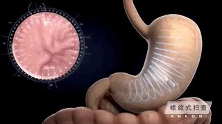 磁控胶囊胃镜需要做心电图吗,30岁可以检查磁控胶囊胃镜吗