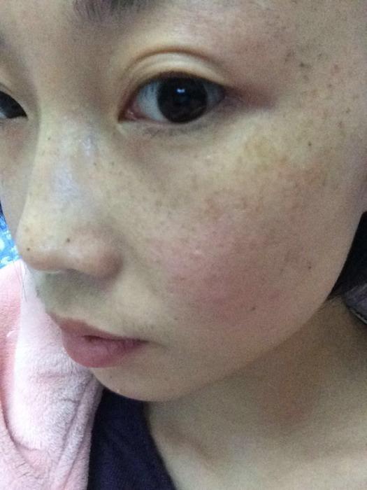 分享祛斑特有效的方法文案,铲除色斑做素颜女神教你祛斑良方