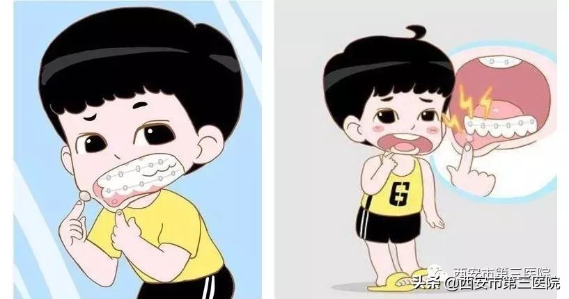 吃火锅治口腔溃疡,吃火锅口腔溃疡是什么原因