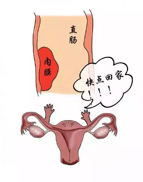 你该知道的妇科那些事,妇科疾病的小常识