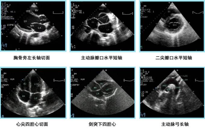 超声的未来,超声设备的发展趋势
