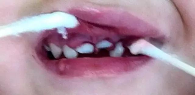 牙痛小知识科普,牙痛小常识分享给大家