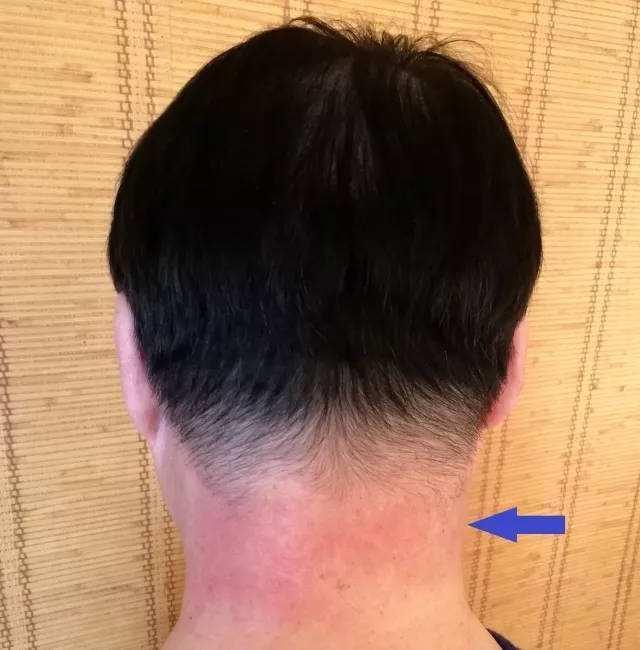 身体不舒服潜水容易发生什么危险,生病潜水最容易导致哪些生命危险