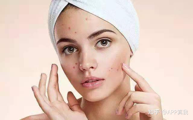 对毛孔友好的粉底液不卡粉起皮,毛孔粗大堵塞什么粉底液好不卡粉
