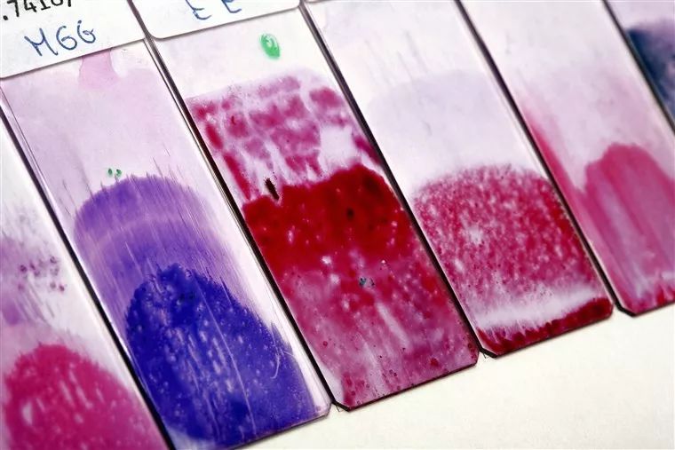 他灌醉了一只豚鼠，战胜了一种癌症，挽救了数百万女性的生命