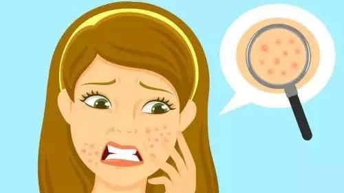 收缩毛孔粗大的方法测评,拯救粗大毛孔的救星来啦