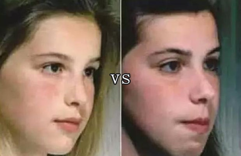 脸上有大痣的男生怎么变帅,脸部长得有痣的男生算丑男吗