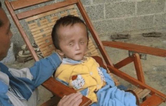 孩子喝到问题奶粉,喝奶粉宝宝脑袋变大事件