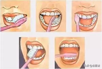 牙齿缝隙越来越大和智齿有关吗,牙齿缝隙越来越大能矫正吗