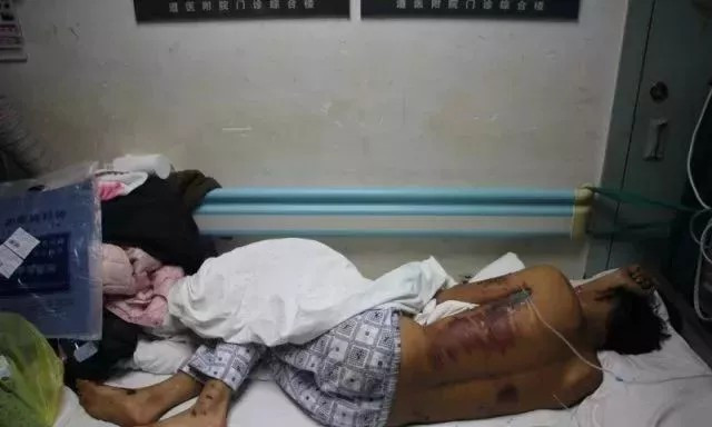 新郎逃婚被撞成重伤,闹婚新郎被闹得高速上悲剧