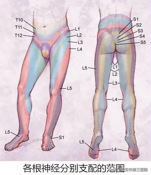 【医者解读】揭开“骶管囊肿”之神秘面纱，查出骶管囊肿都需要治疗吗？（手术病例+文献回忆）