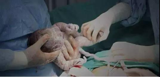 顺产的瞧不起剖腹产？女人何苦难为女人