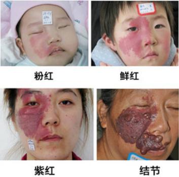 代涛博士的痣长在哪里,代涛博士完整版