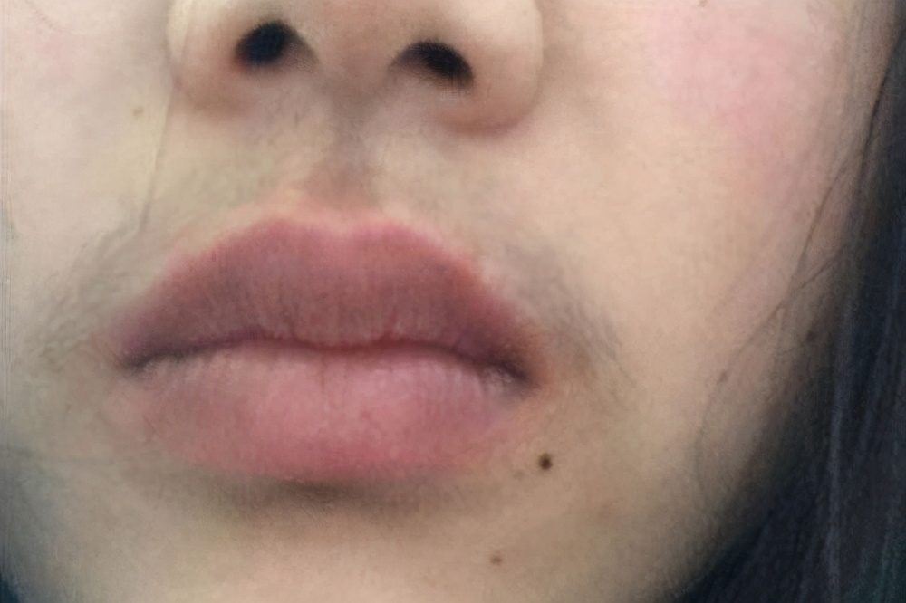 女生长胡子怎么回事？别焦急去掉，明确原因再做决定