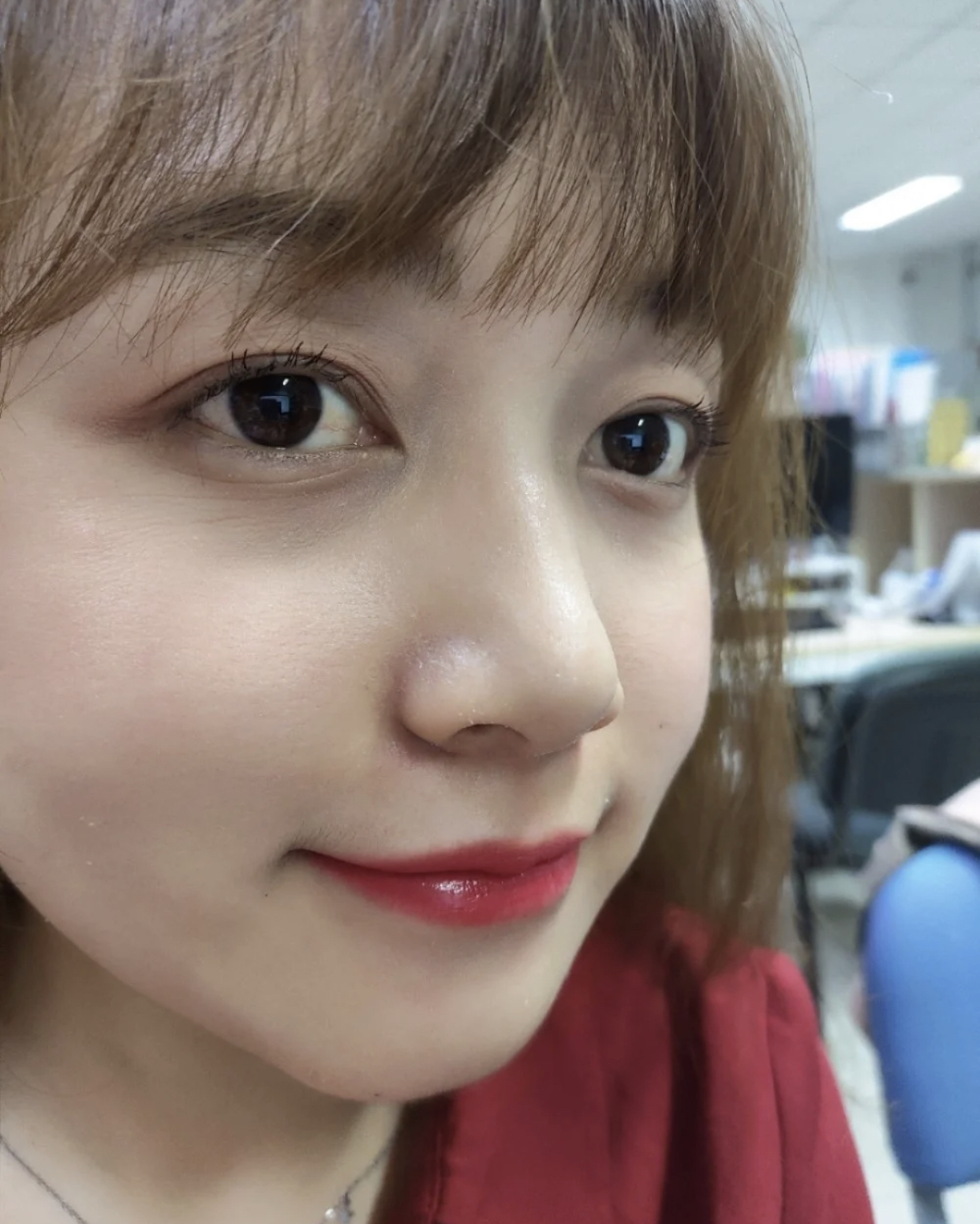 眼尾有皱纹怎么治疗,眼尾沟里面有皱纹怎么办