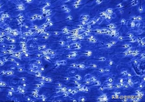 我应该去看生殖科吗？不孕症该怎么查？