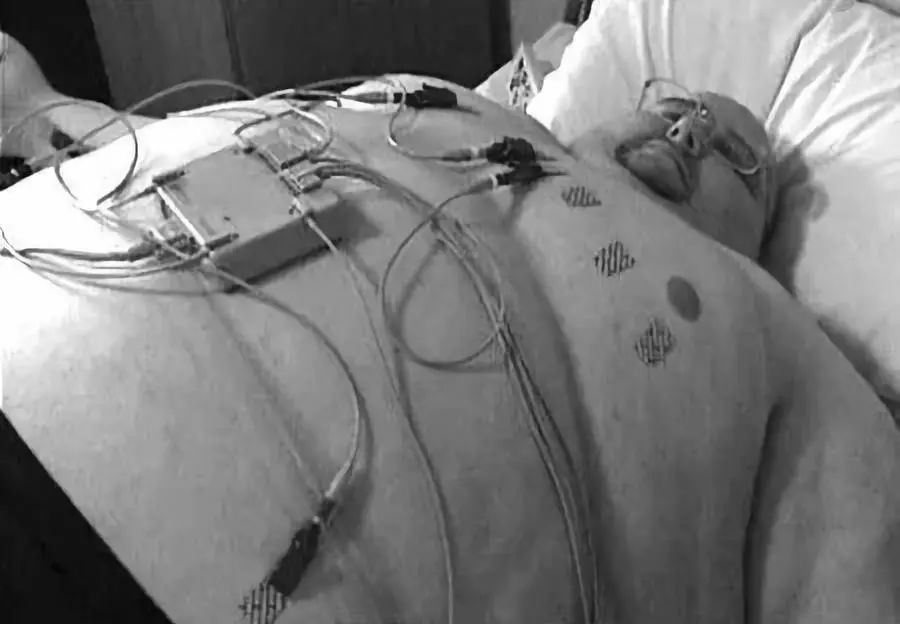 减肥后肚子皮肤松弛大概多久恢复,减肥减得太快了皮松了怎么办